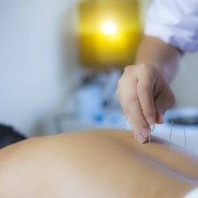 Professional Acupuncture Therapies in North Vancouver