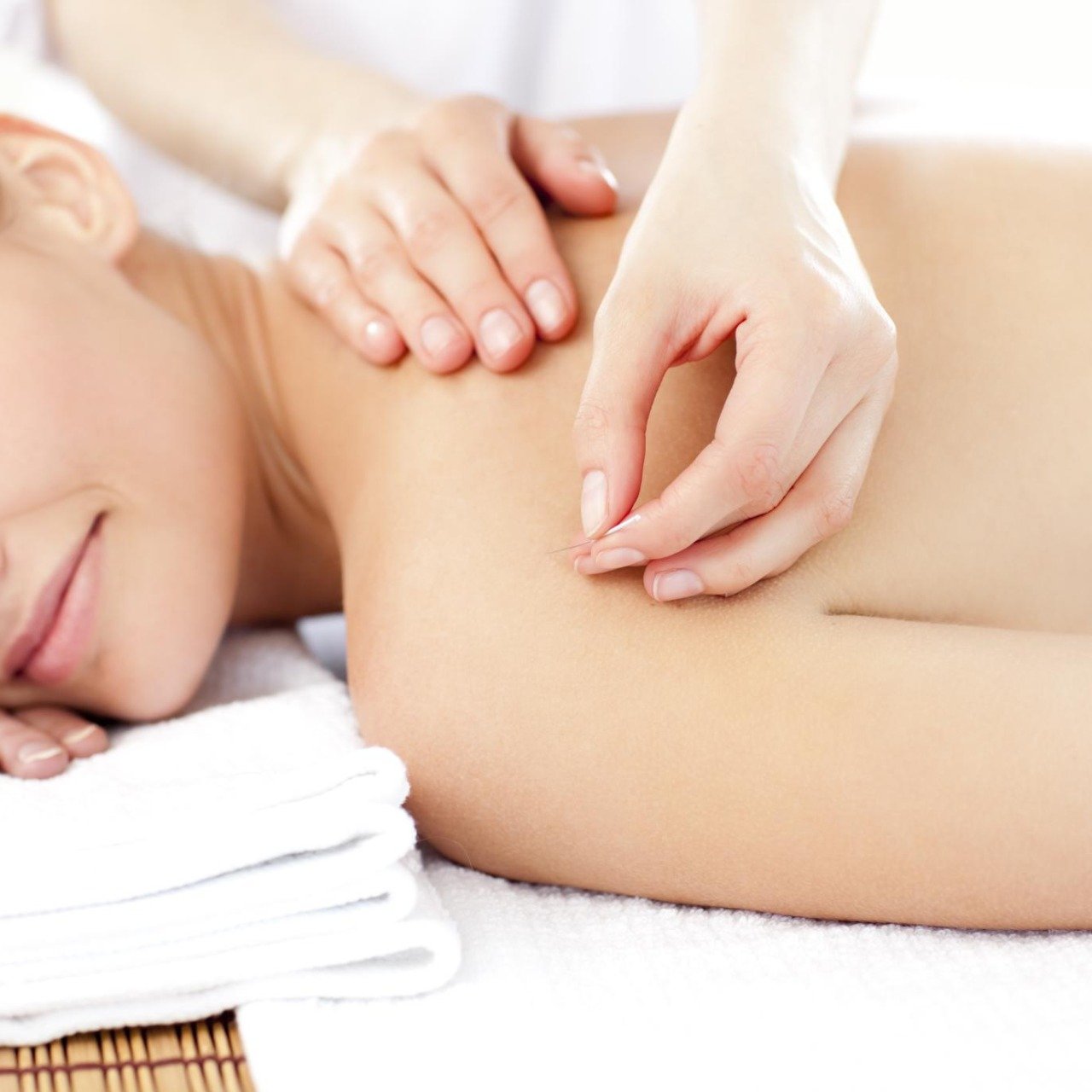 Experienced Acupuncture Therapies in North Vancouver